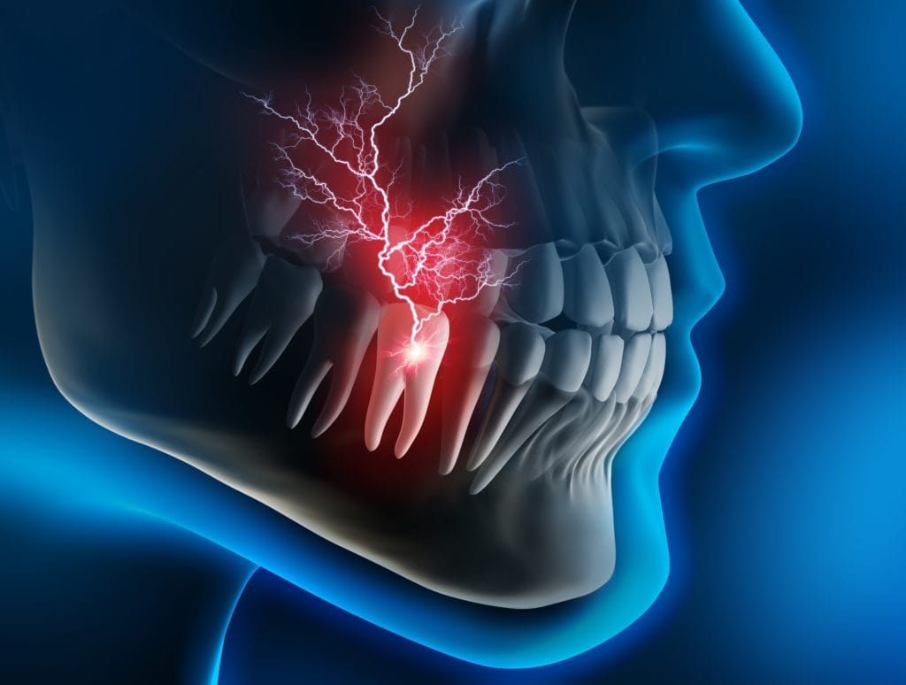 toothache-1024×774